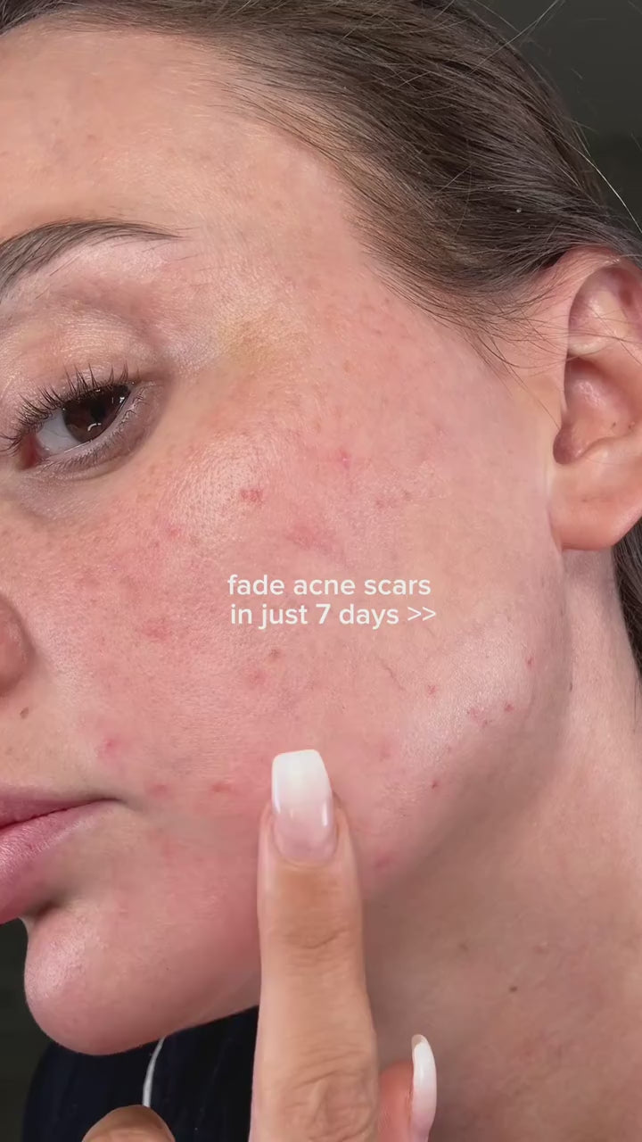 Charger la vidéo : 